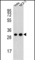 CYC1 Antibody (C-term)