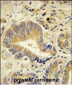 IDUA Antibody (Center)