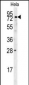 IDUA Antibody (Center)