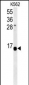 HIST1H2AK Antibody (N-term)