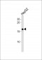 HMGA2 Antibody (C-term)