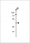 FADS2 Antibody (Center)