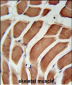 SIKE Antibody (C-term)