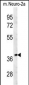 TNFAIP1 Antibody (C-term)