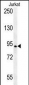 AXIN2 Antibody (C-term)