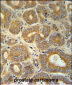 CRABP1 Antibody (C-term)