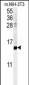 CRABP1 Antibody (C-term)