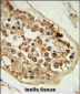 DEPDC1 Antibody (N-term)