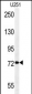 DEPDC1 Antibody (N-term)