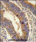 DHX58 Antibody (N-term)