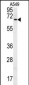 DHX58 Antibody (N-term)