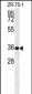 DPF3 Antibody (Center)