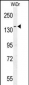 DAAM1-T361 Antibody (N-term)