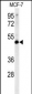 LSP1 Antibody (Center)