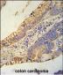 SLC39A10 Antibody (Center)