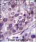 NR3C1 Antibody (Center)