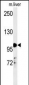 NR3C1 Antibody (Center)