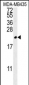 TREM2 Antibody (N-term)