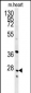 INMT Antibody (Center)