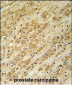 DKC1 Antibody (Center)