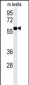 DKC1 Antibody (Center)