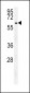 USP17L24 Antibody (C-term)