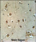 MTCH2 Antibody (N-term)