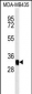 MTCH2 Antibody (N-term)