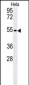 KLF17 Antibody  (C-term)