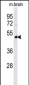 NPTX1-Y344 Antibody