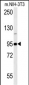 GIT1 (Y554) Antibody (C-term)