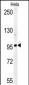 GIT1 (Y554) Antibody (C-term)