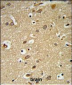 IGF1R Antibody (N-term K66)