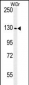 IGF1R Antibody (N-term K66)