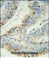 PHLPP2 Antibody (C-term)