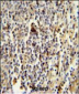 CD1E Antibody (Center)