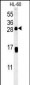 CD69 Antibody (Center)