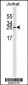 EIF4E Antibody (Ascites)