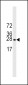 EIF4E Antibody (Ascites)