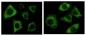 Cytokeratin 5 Antibody