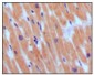 BNP Antibody