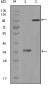 CD20 Antibody