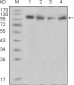 Tyro3 Antibody