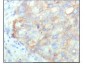 MAP4K4 Antibody