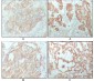 ESR1 Antibody