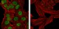 Cytokeratin 19 Antibody