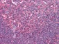TYRO3 Antibody