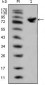 Cytokeratin(Pan) Antibody