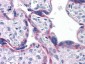 PTH Antibody