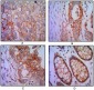 ICAM1 Antibody